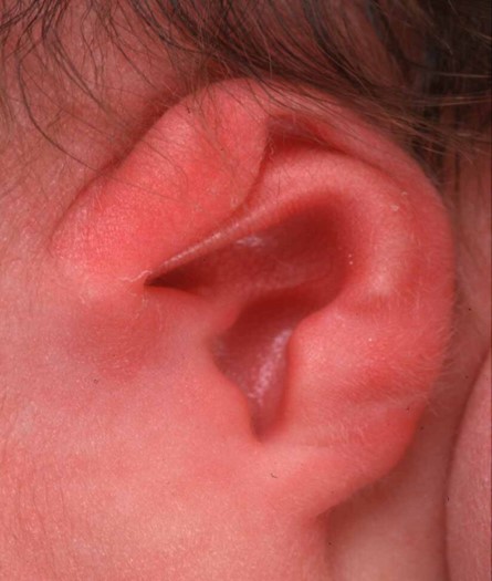 lop-ear-3
