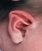 Stahl/Spock Ear